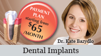 Dental Implants in Mississauga